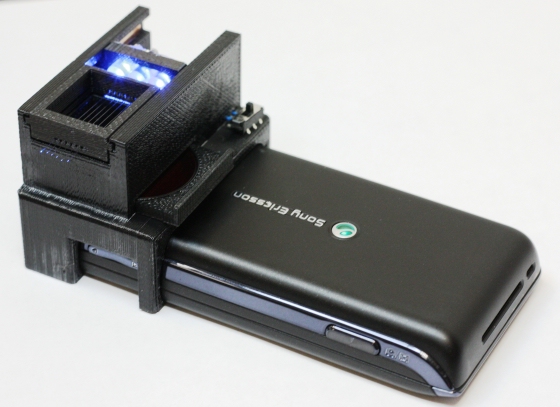 This cellphone attachment detects E.Coli disease in your food 1 OzcanE.coli-prv