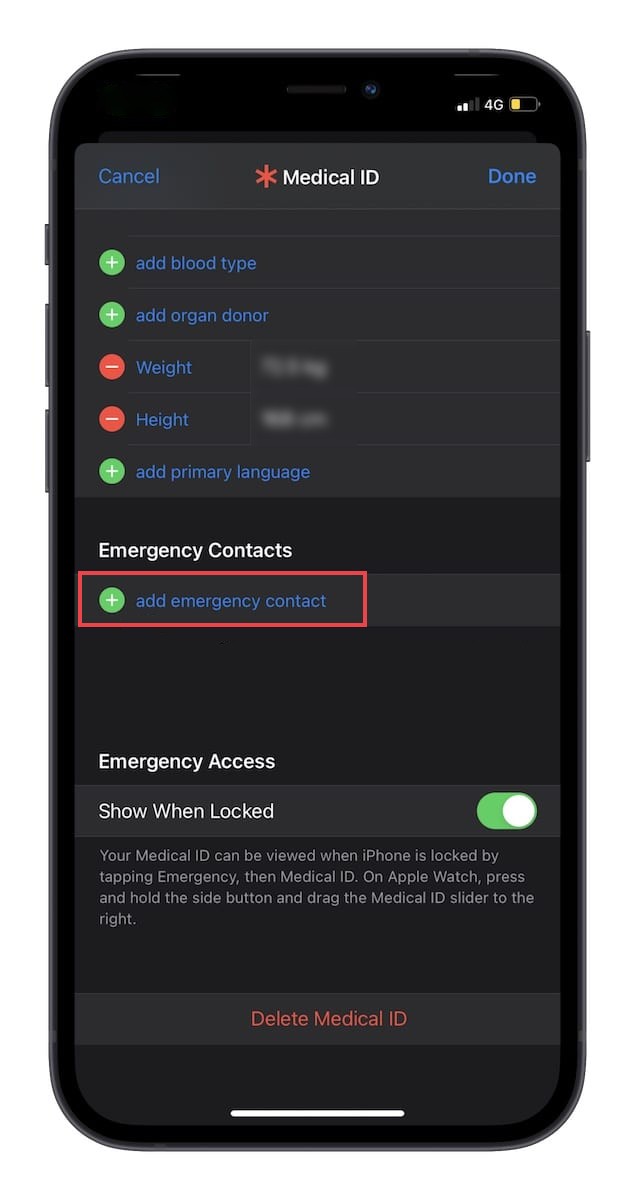 Add Emergency Contact to Apple Watch